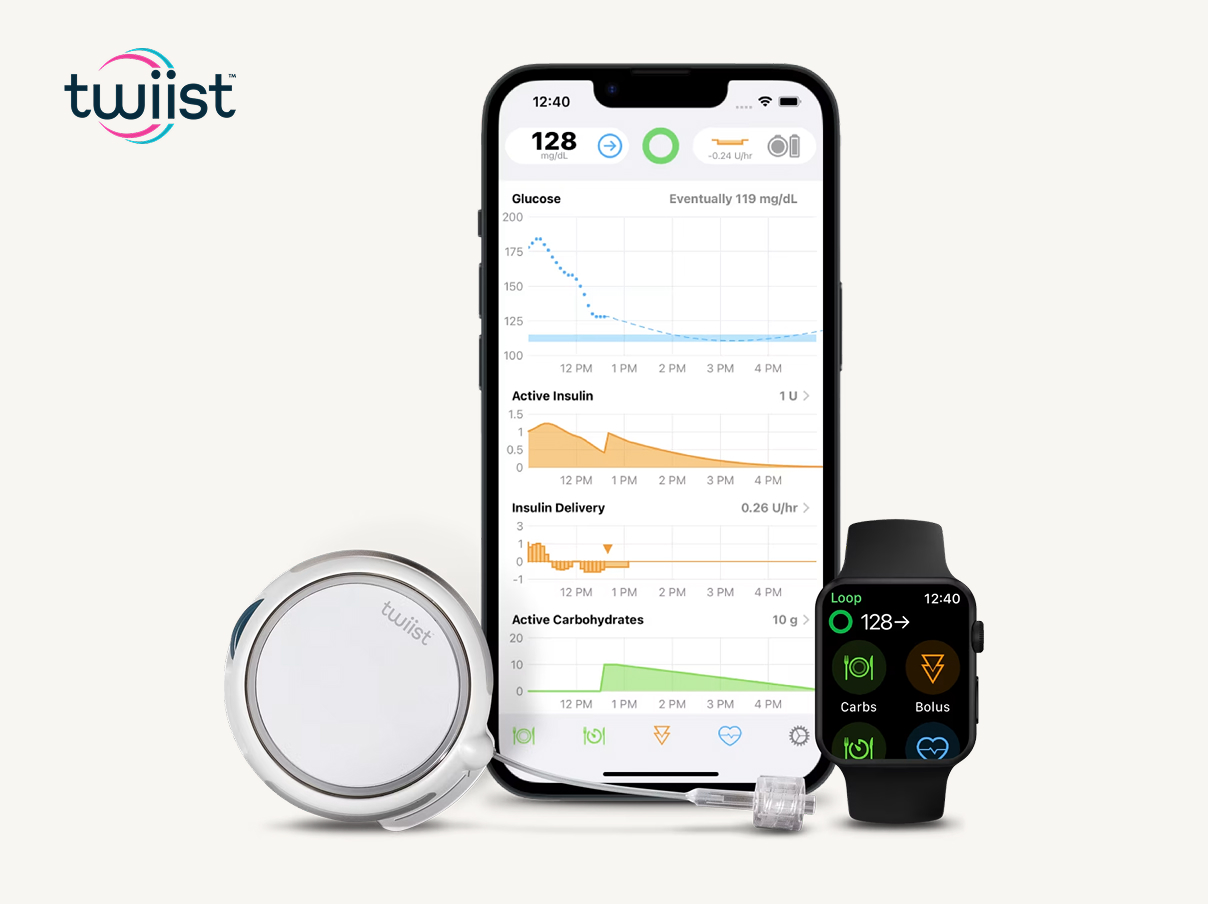 Eversense 365 cgm integrates with twiist automated insulin delivery systems