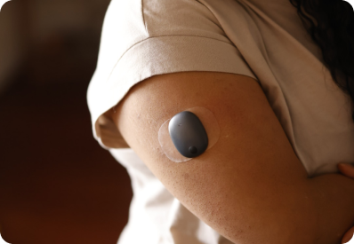 A person's arm with a circular Eversense CGM sensor attached